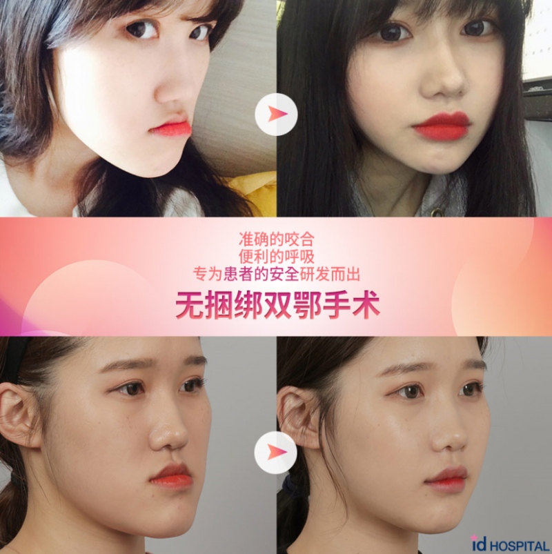 QQ截图20190422182702.png