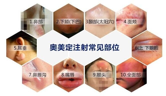 李方奇